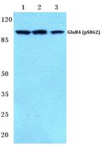 Phospho-GluR4 (Ser862) Antibody in Western Blot (WB)