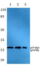 Phospho-p27 Kip1 (Thr198) Antibody in Western Blot (WB)