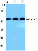 Phospho-SOX9 (Ser181) Antibody in Western Blot (WB)