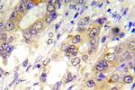 Phospho-TSC2 (Thr1462) Antibody in Immunohistochemistry (Paraffin) (IHC (P))