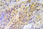 Phospho-CHK2 (Thr387) Antibody in Immunohistochemistry (Paraffin) (IHC (P))