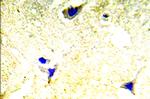 PAK1/PAK2 Antibody in Immunohistochemistry (Paraffin) (IHC (P))