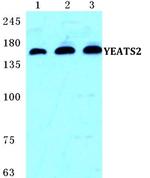YEATS2 Antibody in Western Blot (WB)