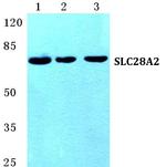 SLC28A2 Antibody in Western Blot (WB)
