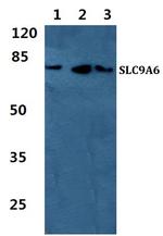 SLC9A6 Antibody in Western Blot (WB)