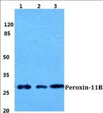 PEX11B Antibody in Western Blot (WB)