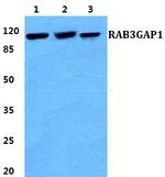 RAB3GAP1 Antibody in Western Blot (WB)