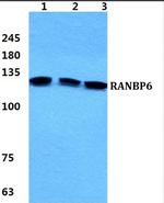 RANBP6 Antibody in Western Blot (WB)