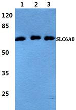 SLC6A8 Antibody in Western Blot (WB)