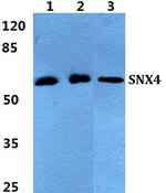 SNX4 Antibody in Western Blot (WB)