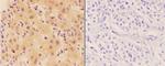 ORM2 Antibody in Immunohistochemistry (Paraffin) (IHC (P))