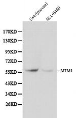 MTM1 Antibody in Western Blot (WB)