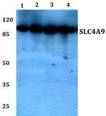 SLC4A9 Antibody in Western Blot (WB)