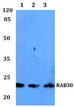 RAB30 Antibody in Western Blot (WB)