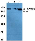 SCN8A Antibody in Western Blot (WB)