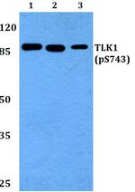 Phospho-TLK1 (Ser743) Antibody in Western Blot (WB)