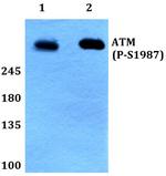 Phospho-ATM (Ser1987) Antibody in Western Blot (WB)