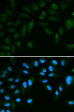 SPINLW1 Antibody in Immunocytochemistry (ICC/IF)