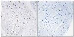 Phospho-Blooms Syndrome (Thr99) Antibody in Immunohistochemistry (Paraffin) (IHC (P))