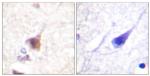 Phospho-CaMKIV (Thr196, Thr200) Antibody in Immunohistochemistry (Paraffin) (IHC (P))