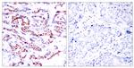 Phospho-ATF2 (Ser94, Ser112) Antibody in Immunohistochemistry (Paraffin) (IHC (P))