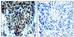 Phospho-p38 MAPK (Thr180) Antibody in Immunohistochemistry (Paraffin) (IHC (P))