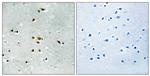 Phospho-FER (Tyr402) Antibody in Immunohistochemistry (Paraffin) (IHC (P))