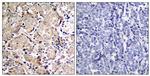 Phospho-FOXO1 (Ser319) Antibody in Immunohistochemistry (Paraffin) (IHC (P))