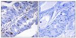 Phospho-NR4A1 (Ser351) Antibody in Immunohistochemistry (Paraffin) (IHC (P))