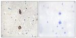 Phospho-IGFBP3 (Ser183) Antibody in Immunohistochemistry (Paraffin) (IHC (P))