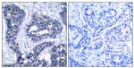 Phospho-IRS1 (Ser639) Antibody in Immunohistochemistry (Paraffin) (IHC (P))