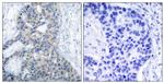 Phospho-Stathmin 1 (Ser38) Antibody in Immunohistochemistry (Paraffin) (IHC (P))