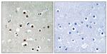 Phospho-MEF2C (Ser396) Antibody in Immunohistochemistry (Paraffin) (IHC (P))