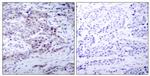 Phospho-NFkB p100 (Ser870) Antibody in Immunohistochemistry (Paraffin) (IHC (P))