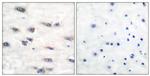 Phospho-TrkA (Tyr791) Antibody in Immunohistochemistry (Paraffin) (IHC (P))