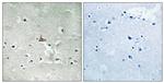 Phospho-TrkB (Tyr706, Tyr707) Antibody in Immunohistochemistry (Paraffin) (IHC (P))