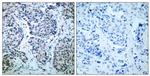 Phospho-MAP2K4 (Thr261) Antibody in Immunohistochemistry (Paraffin) (IHC (P))