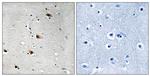 Phospho-TCF3 (Thr355) Antibody in Immunohistochemistry (Paraffin) (IHC (P))