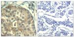 Phospho-Cofilin 1/2 (Tyr88) Antibody in Immunohistochemistry (Paraffin) (IHC (P))