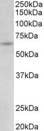 Uromodulin Antibody in Western Blot (WB)