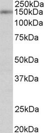 SynGAP Antibody in Western Blot (WB)