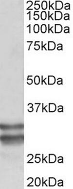 RFLAT-1 Antibody in Western Blot (WB)