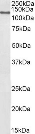 DBC1 Antibody in Western Blot (WB)