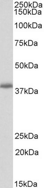 PDLIM2 Antibody in Western Blot (WB)