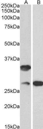 C16orf57 Antibody in Western Blot (WB)