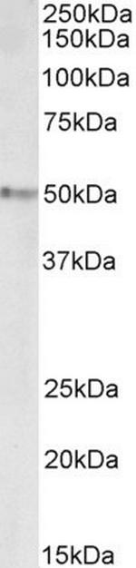 STAP2 Antibody in Western Blot (WB)