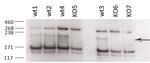 ZCCHC11 Antibody in Western Blot (WB)