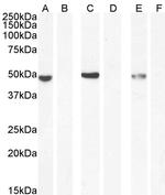 NAT8L Antibody in Western Blot (WB)