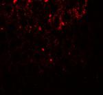 SHBG Antibody in Immunohistochemistry (IHC)