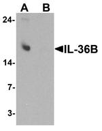 IL36B Antibody in Western Blot (WB)